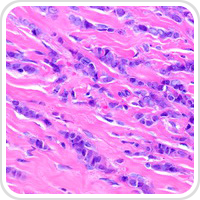 thumbnail image of Breast microscope section