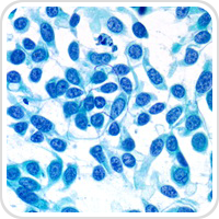 thumbnail image of Cytopathology microscope section