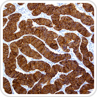 thumbnail image of Endocrine microscope section