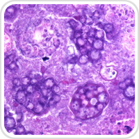 thumbnail image of Infectious Disease microscope section
