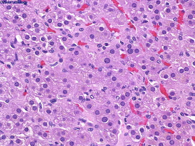 Adrenal_Histology4.jpg