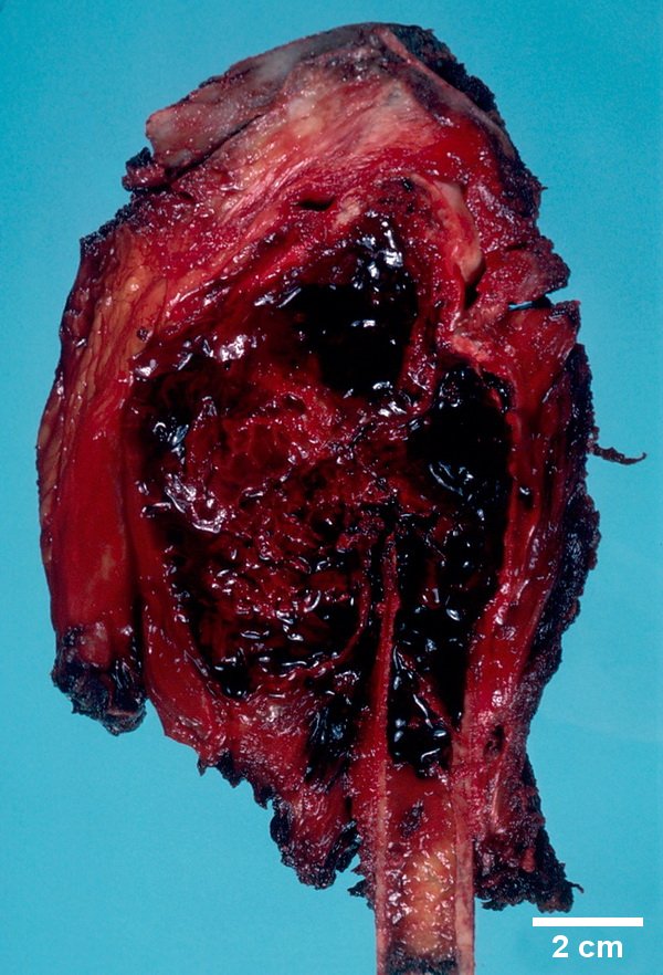 Webpathology.com: A Collection of Surgical Pathology Images