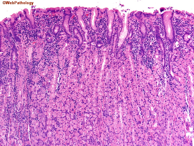 Stomach_Histology_FundicGlands1.jpg