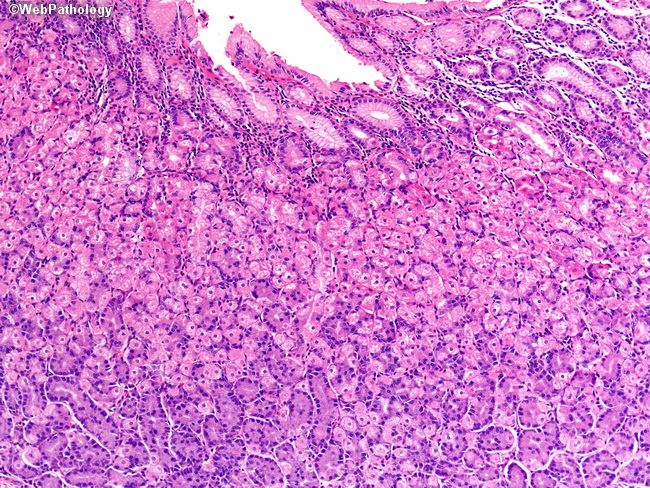 Stomach_Histology_FundicGlands2.jpg
