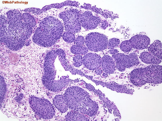 UrinaryBladder_Histology4.jpg
