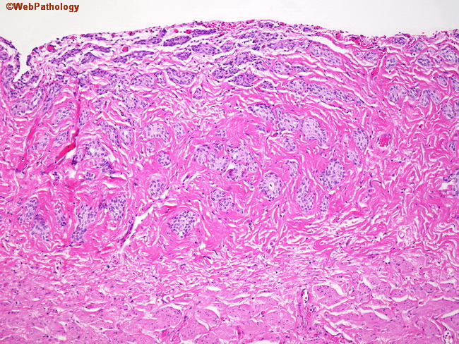 UrinaryBladder_Histology6.jpg