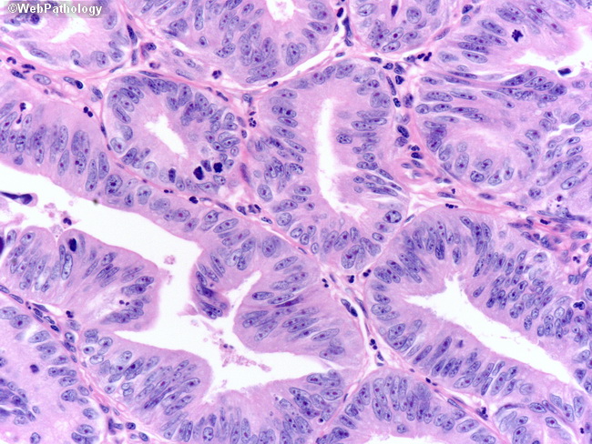 A Collection of Surgical Pathology Images