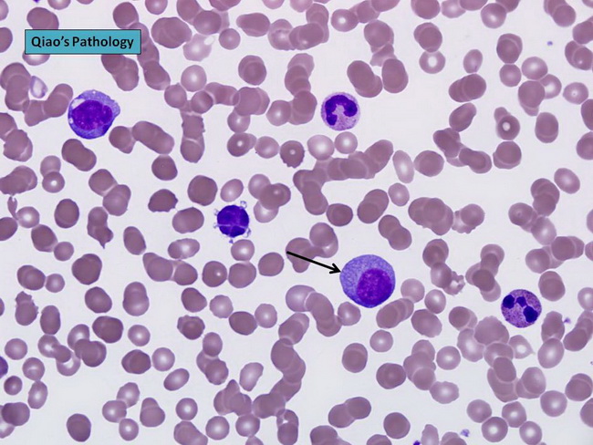 plasma cells histology