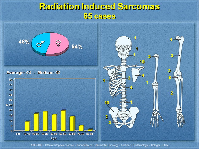Osteosarcoma11_RadiationInduced_Resized.jpg
