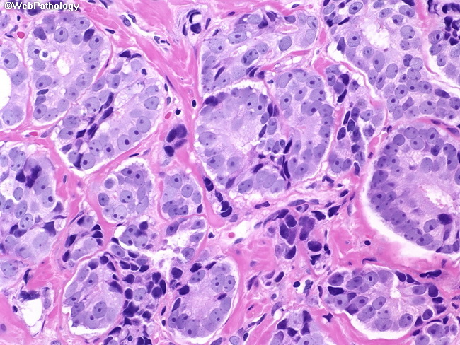 pathology cancer