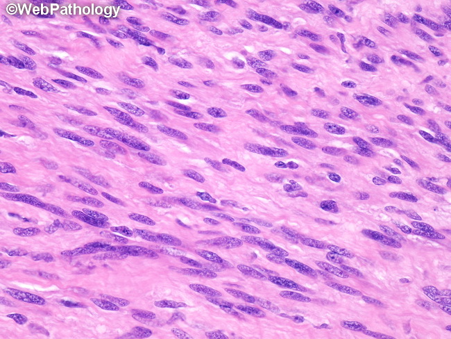 Schwann Cells Histology