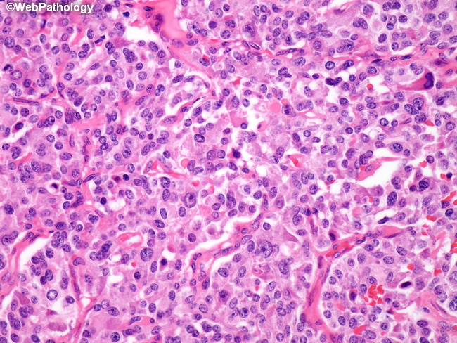 A Collection Of Surgical Pathology Images 